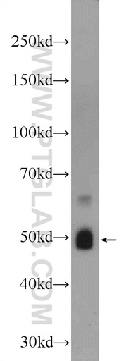[24816-1-AP-150UL] ZRANB2 Polyclonal antibody