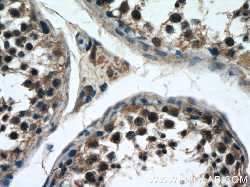 [24823-1-AP-150UL] ZNF658 Polyclonal antibody