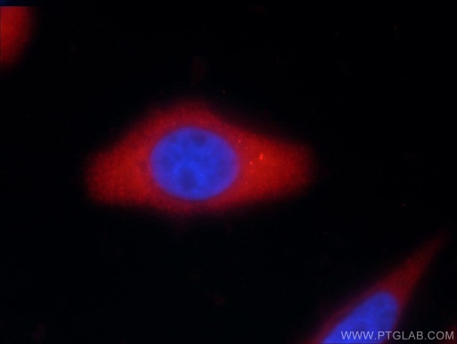 [24824-1-AP-20UL] Vertnin Polyclonal antibody