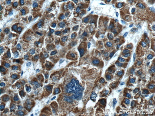 [24827-1-AP-20UL] GLDC Polyclonal antibody