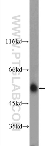 [24833-1-AP-20UL] ARMC5 Polyclonal antibody