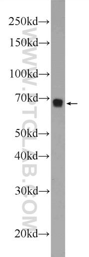 [24835-1-AP-20UL] FOXD4 Polyclonal antibody