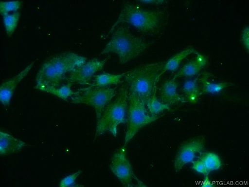 [24836-1-AP-150UL] BAIAP3 Polyclonal antibody