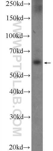 [24837-1-AP-150UL] POTEH Polyclonal antibody