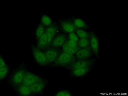 [24840-1-AP-150UL] SETD7 Polyclonal antibody