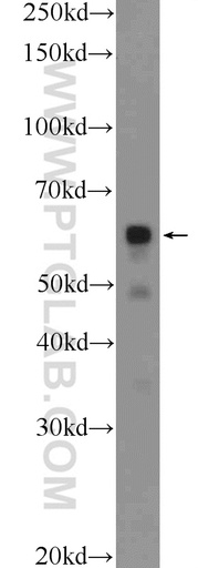 [24842-1-AP-150UL] PDF Polyclonal antibody