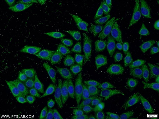 [24847-1-AP-20UL] KLHDC5 Polyclonal antibody