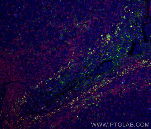[24849-1-AP-20UL] VISTA Polyclonal antibody