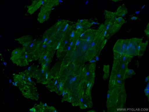 [24851-1-AP-150UL] GAL3ST3 Polyclonal antibody