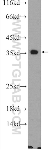 [24854-1-AP-20UL] CNTD1 Polyclonal antibody