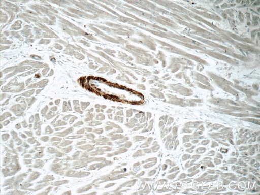 [24855-1-AP-150UL] Calponin Polyclonal antibody