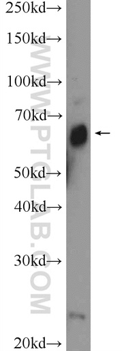 [24861-1-AP-20UL] ZNF195 Polyclonal antibody