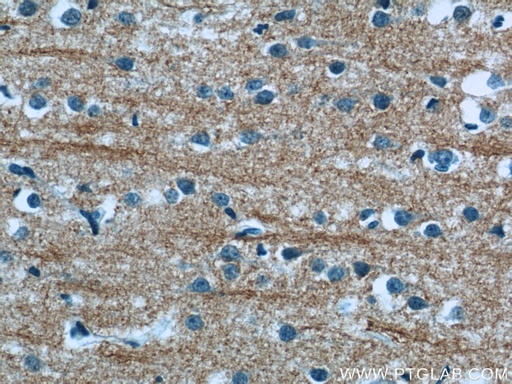 [24862-1-AP-20UL] NMU Polyclonal antibody