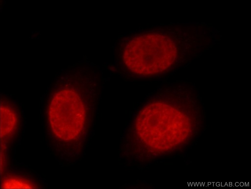 [24864-1-AP-150UL] FUBP1 Polyclonal antibody