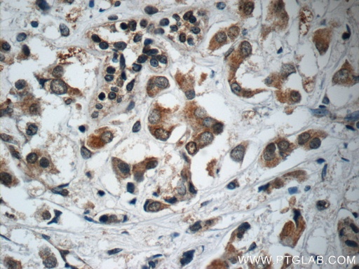 [24865-1-AP-20UL] C13orf37 Polyclonal antibody