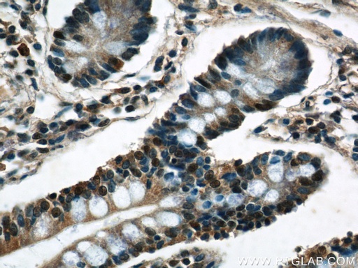 [24867-1-AP-20UL] C22orf41 Polyclonal antibody