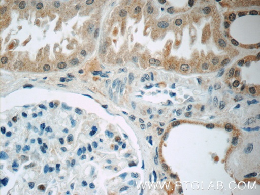 [24872-1-AP-150UL] CWF19L2 Polyclonal antibody