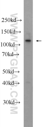 [24880-1-AP-150UL] KIAA1217 Polyclonal antibody