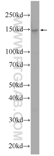 [24881-1-AP-20UL] URB2 Polyclonal antibody