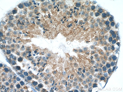 [24883-1-AP-150UL] PLEKHO1 Polyclonal antibody