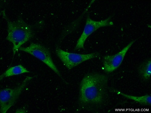[24896-1-AP-20UL] CCT2 Polyclonal antibody