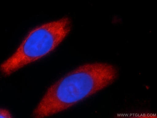 [24897-1-AP-20UL] GEMIN5 Polyclonal antibody