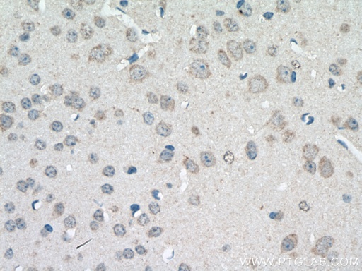 [24901-1-AP-20UL] SLC22A23 Polyclonal antibody