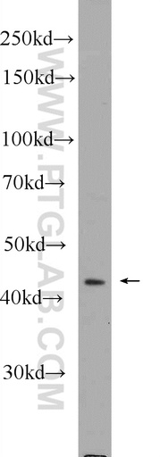 [24903-1-AP-150UL] SOX17 Polyclonal antibody