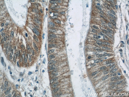 [24904-1-AP-20UL] TMEM190 Polyclonal antibody