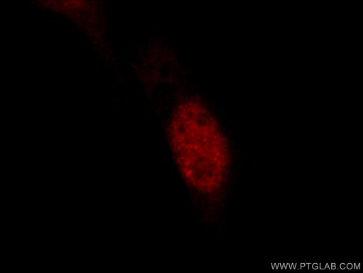 [24909-1-AP-20UL] JUN Polyclonal antibody
