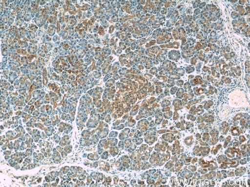 [24917-1-AP-150UL] WFDC3 Polyclonal antibody