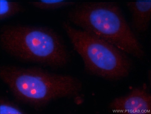 [24921-1-AP-20UL] KIAA0774 Polyclonal antibody
