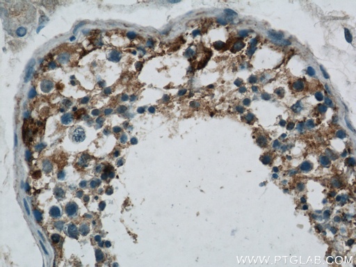 [24923-1-AP-150UL] DHX35 Polyclonal antibody