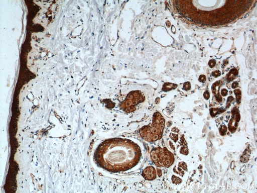 [24925-1-AP-150UL] ST3GAL3 Polyclonal antibody