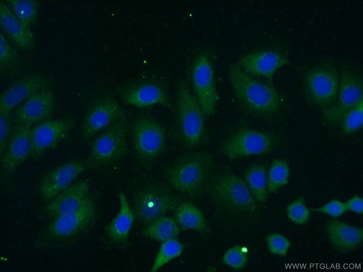 [24926-1-AP-20UL] ILK Polyclonal antibody
