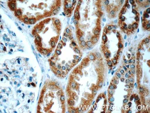 [24927-1-AP-150UL] TMEM213 Polyclonal antibody