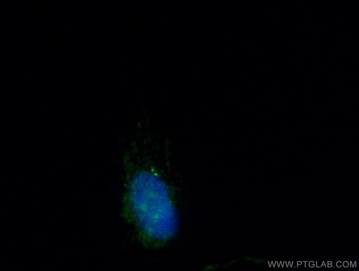 [24928-1-AP-20UL] CEP112 Polyclonal antibody
