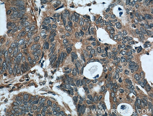 [24929-1-AP-20UL] FAM155A Polyclonal antibody