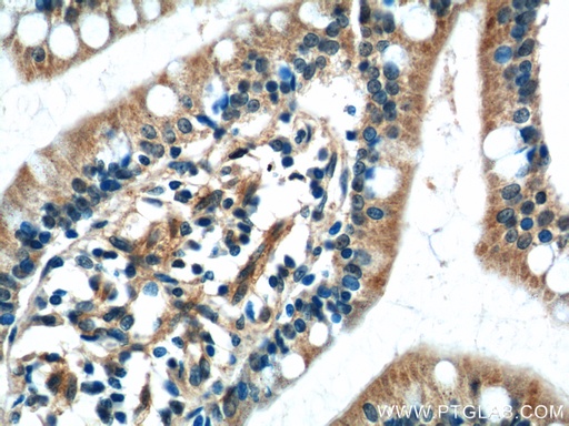 [24930-1-AP-150UL] C2orf47 Polyclonal antibody