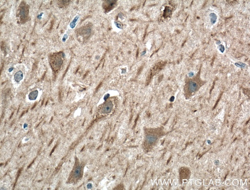 [24931-1-AP-20UL] SRBD1 Polyclonal antibody