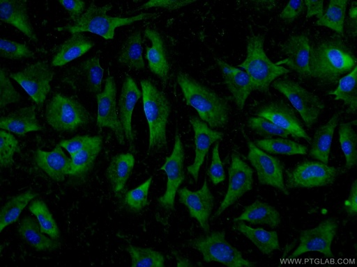 [24934-1-AP-20UL] ADAMTS12 Polyclonal antibody
