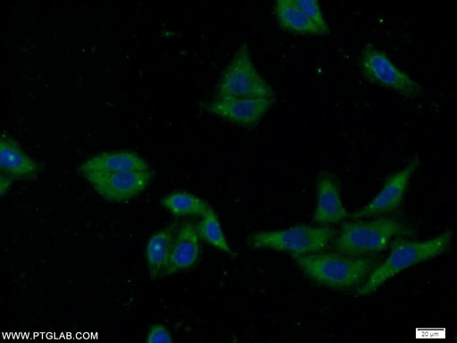 [24935-1-AP-150UL] SEC61 Alpha Polyclonal antibody