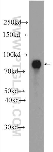 [24936-1-AP-20UL] ProSAPiP1 Polyclonal antibody