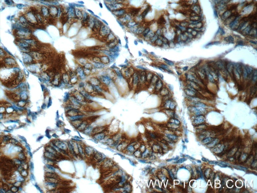 [24937-1-AP-20UL] FPGT Polyclonal antibody