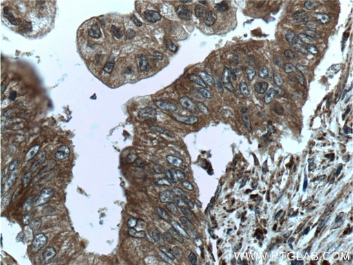 [24944-1-AP-20UL] ME2 Polyclonal antibody