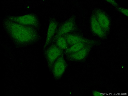 [24946-1-AP-20UL] PRPF38A Polyclonal antibody
