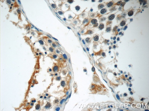 [24947-1-AP-150UL] KIAA0182 Polyclonal antibody