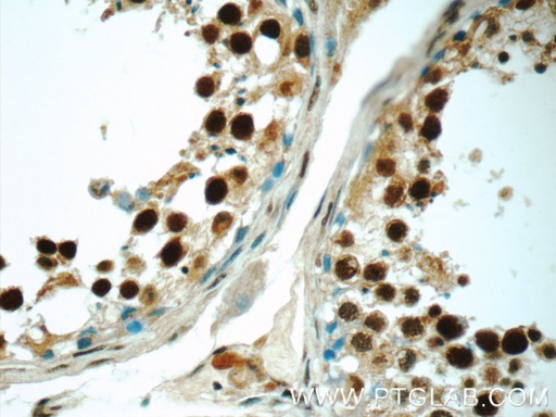 [24949-1-AP-150UL] HIC1 Polyclonal antibody
