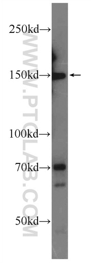 [24954-1-AP-20UL] ATAD5 Polyclonal antibody