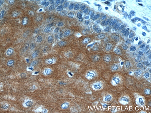 [24956-1-AP-20UL] LCE1A Polyclonal antibody